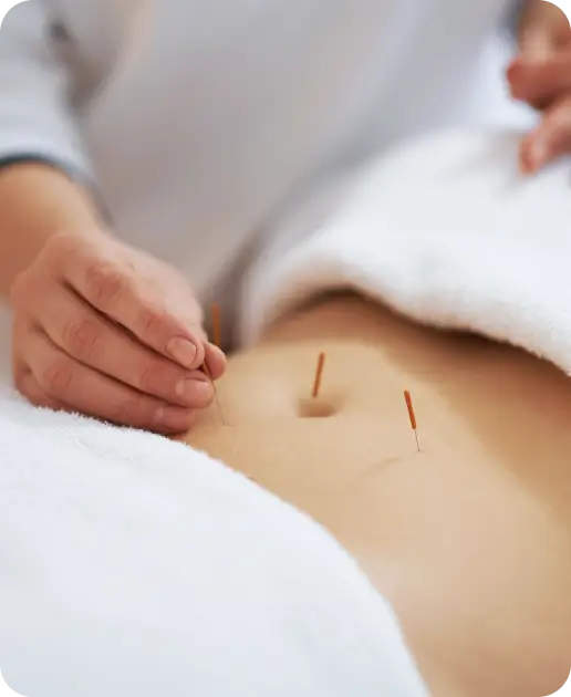 Acupuncture for Weight Loss